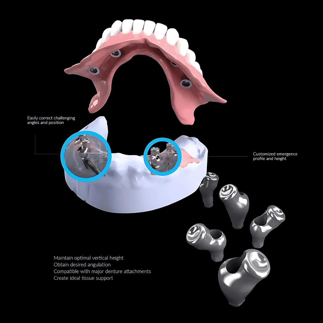 Case Study TruAbutment TL Custom Overdenture Solution Dental Valution