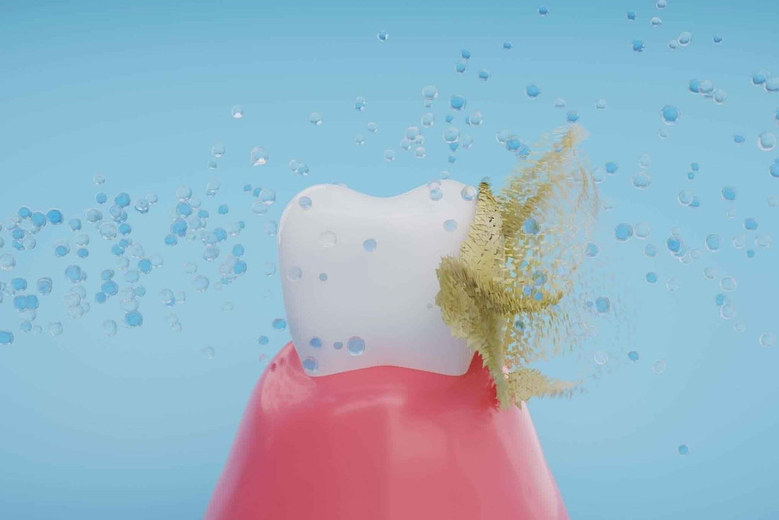 Say Goodbye to Tartar: Mastering the Art of Plaque Removal at Home - Dental Valution