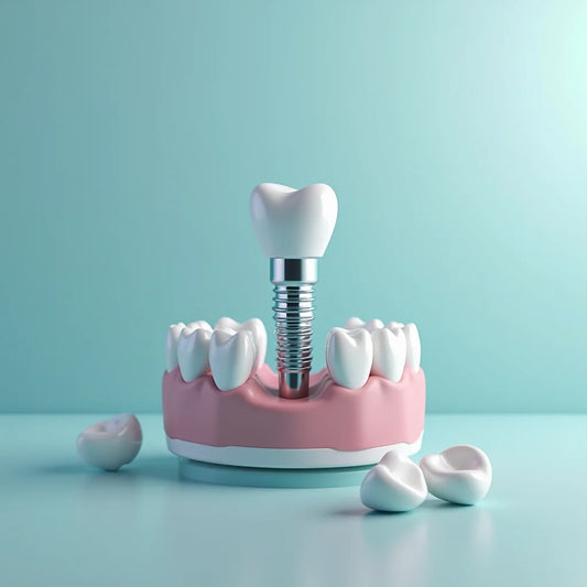 Implant Supported Dentures Lab Guide for Practitioners - Dental Valution