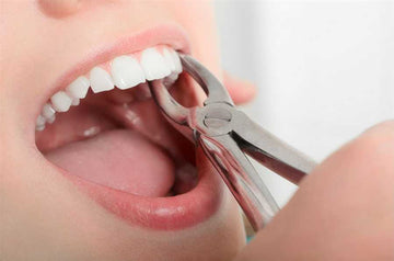 Case Study: Managing Complications During Tooth Extraction - Dental Valution