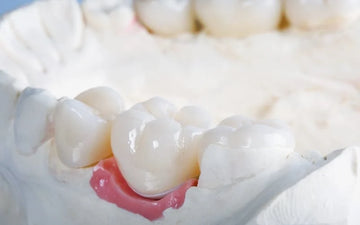 Advancing Dental Crown Restorations: Innovative Composite Materials in Just 35 Minutes - Dental Valution