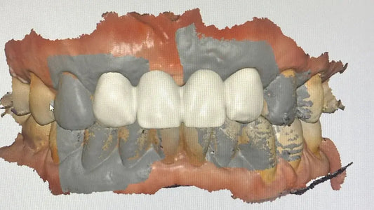 Embracing Digital Workflows in Dentistry: A Game-Changer for Analogue Practices - Dental Valution