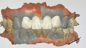 Embracing Digital Workflows in Dentistry: A Game-Changer for Analogue Practices - Dental Valution