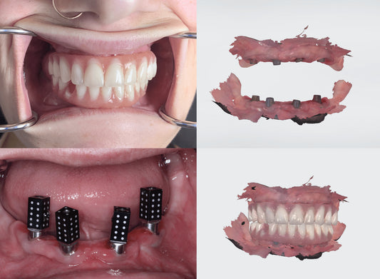 Photogrammetry in Dentistry: Transforming Treatment Planning and Outcomes