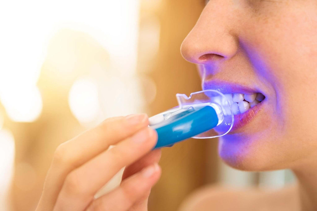 Beauty or Blunder? Understanding the Risks of DIY Teeth Whitening Gone Wrong - Dental Valution