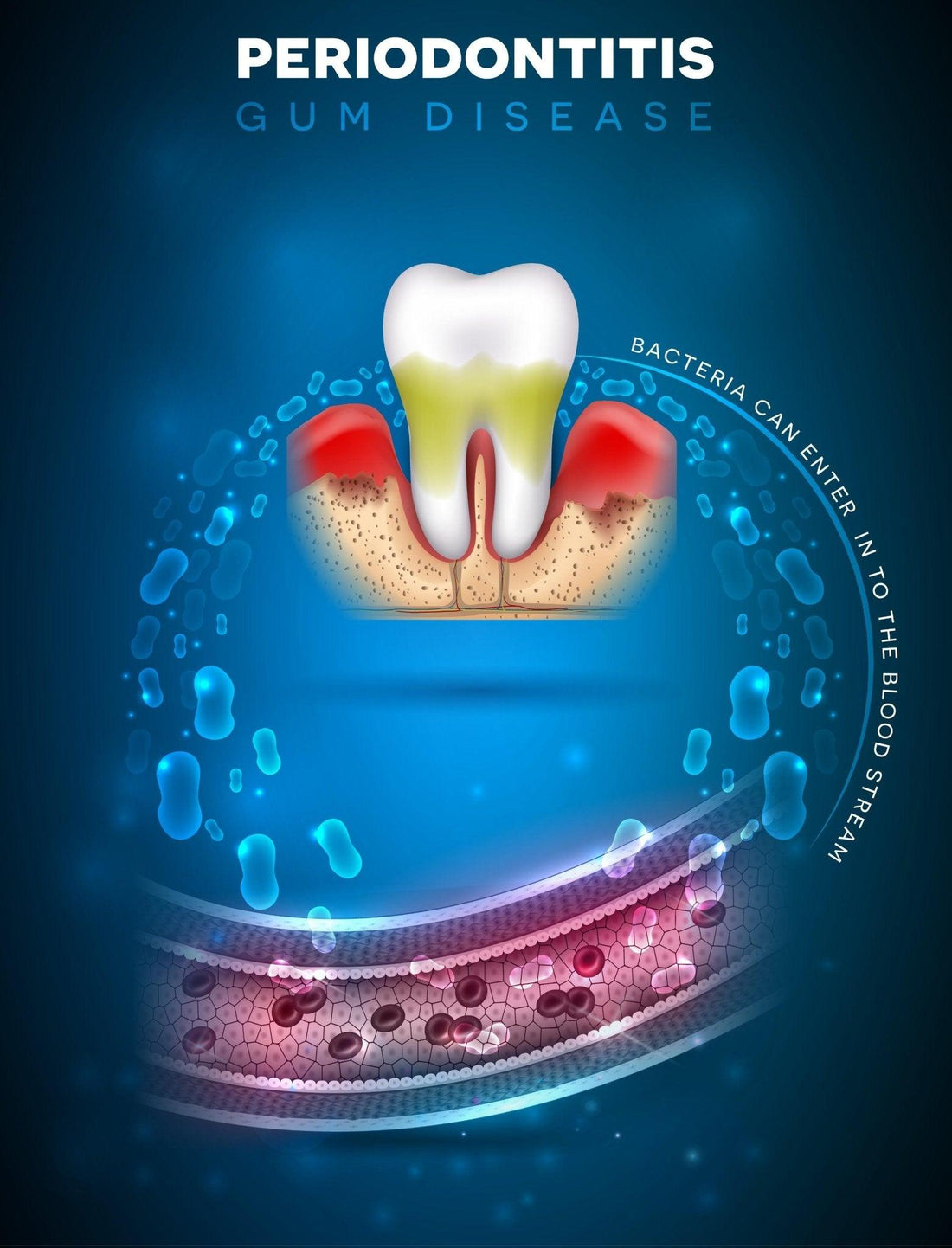 Exploring the Link Between Gum Disease and Diabetes - Dental Valution