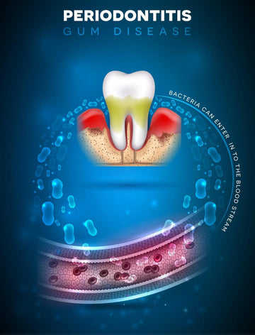 Exploring the Link Between Gum Disease and Diabetes - Dental Valution