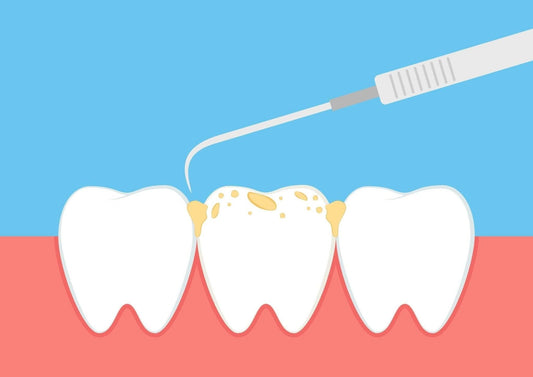 From Fillings to Extractions: Navigating Common Dental Procedures with Ease - Dental Valution