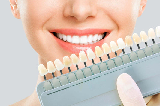 From Veneers to Whitening: Exploring the Wonders of Cosmetic Dentistry - Dental Valution